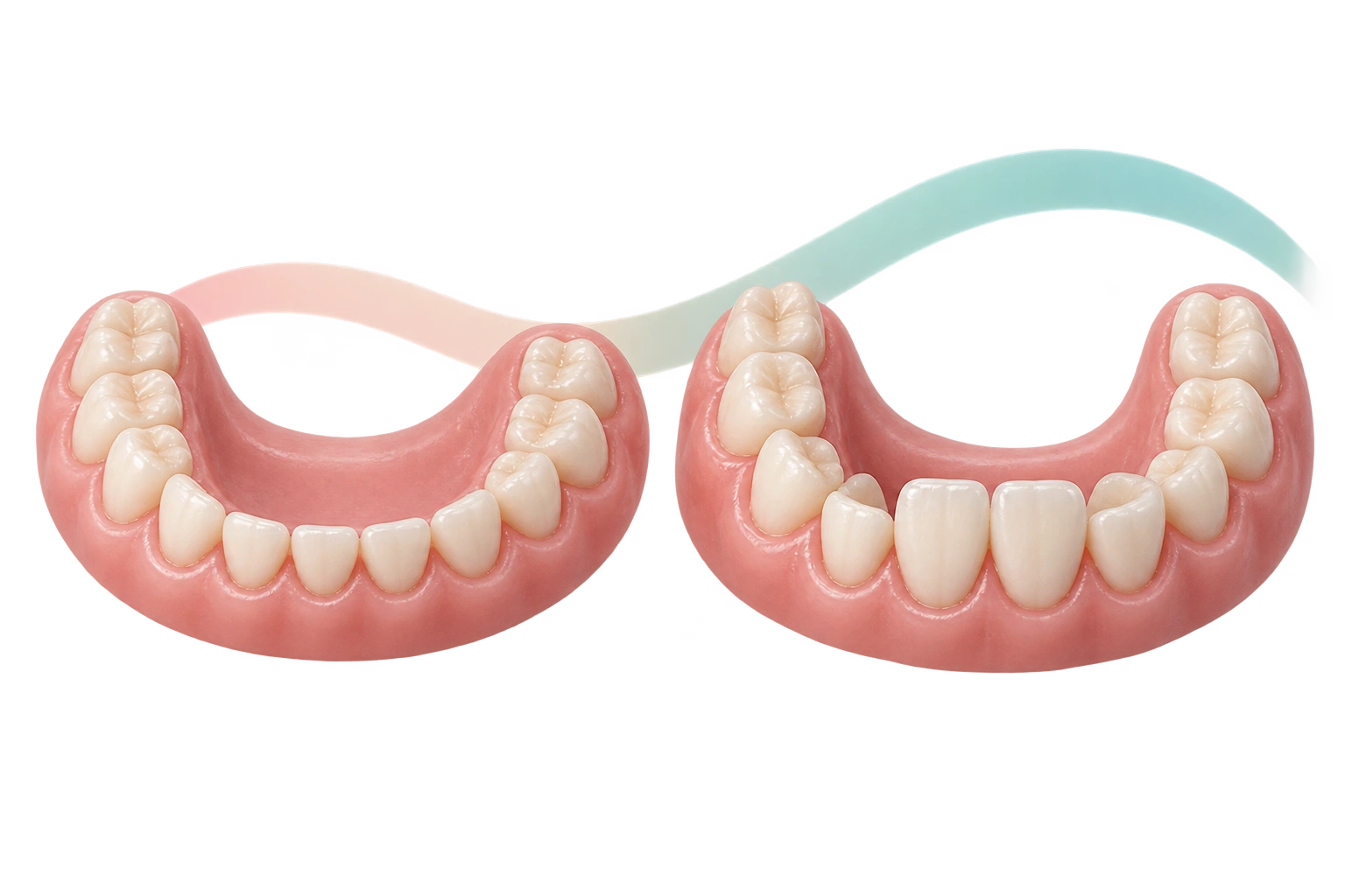 Modelli dentali che richiamano la dentizione decidua e mista